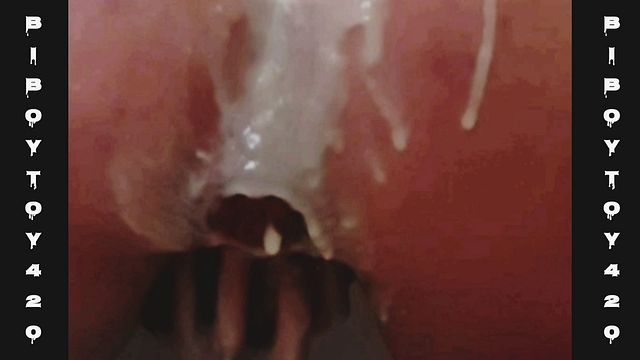 Twink Gets Anal Enema with Creamy Prolapse Finish