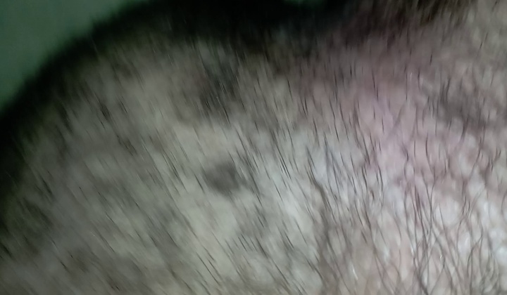 1000024380  ?